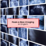 Peek-a-boo Imaging